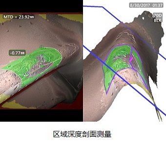 高清工業內窺鏡MViQ HD區域深度剖面測量